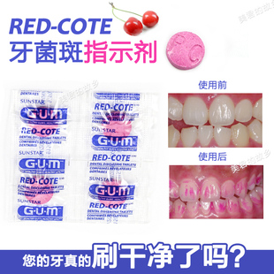 牙齿牙菌斑显示剂 牙菌斑指示剂牙齿牙垢检测显示片菌斑染色剂