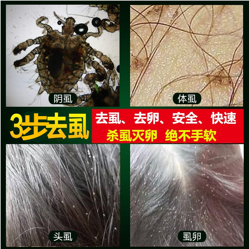 去儿童头虱虱立净除成人阴虱虱子药一扫光儿童玉锦诗乐净精华灵膏