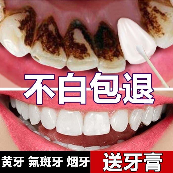 牙齿美白速效神器去黄牙烟渍牙渍牙垢牙结石氟斑牙洗牙粉液非牙贴