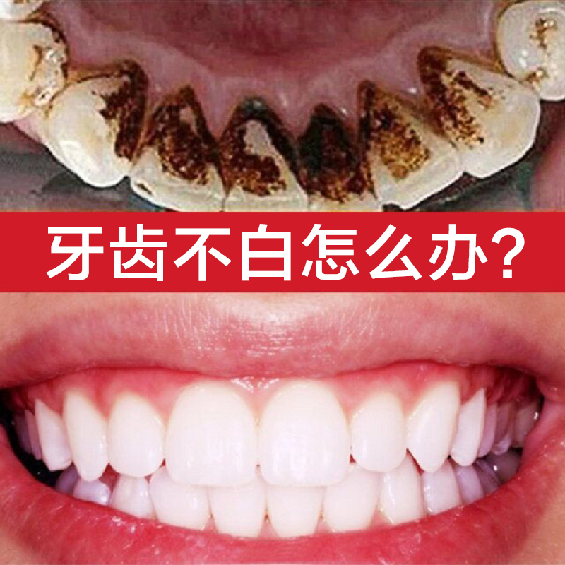 【刷牙就能白】云南本草速效去黄牙烟牙美白牙粉去牙结石牙菌斑