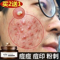 祛痘印膏去痘痘坑痘疤修复送洗面奶产品前女五男士强淡化粉刺凹洞