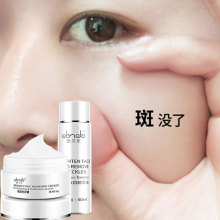 思兰朵ka品去斑美白iz雀斑遗传斑黄褐斑强力祛色斑神器
