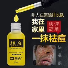 祛痘膏pp华液痘痘贴nj茶树痤疮暗疮青春痘粉刺李佳琦去痘神器