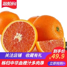秭归中sm当季新鲜水db脐橙基地包邮直发净重9斤带箱10斤