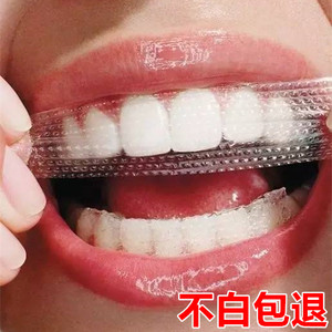 【氟斑牙美白牙贴神器价格】最新氟斑牙美白牙