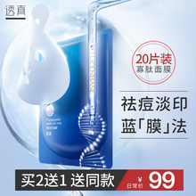 透真寡xj面膜女补水wp痘淡化痘印清洁控油收缩毛孔面膜男正品